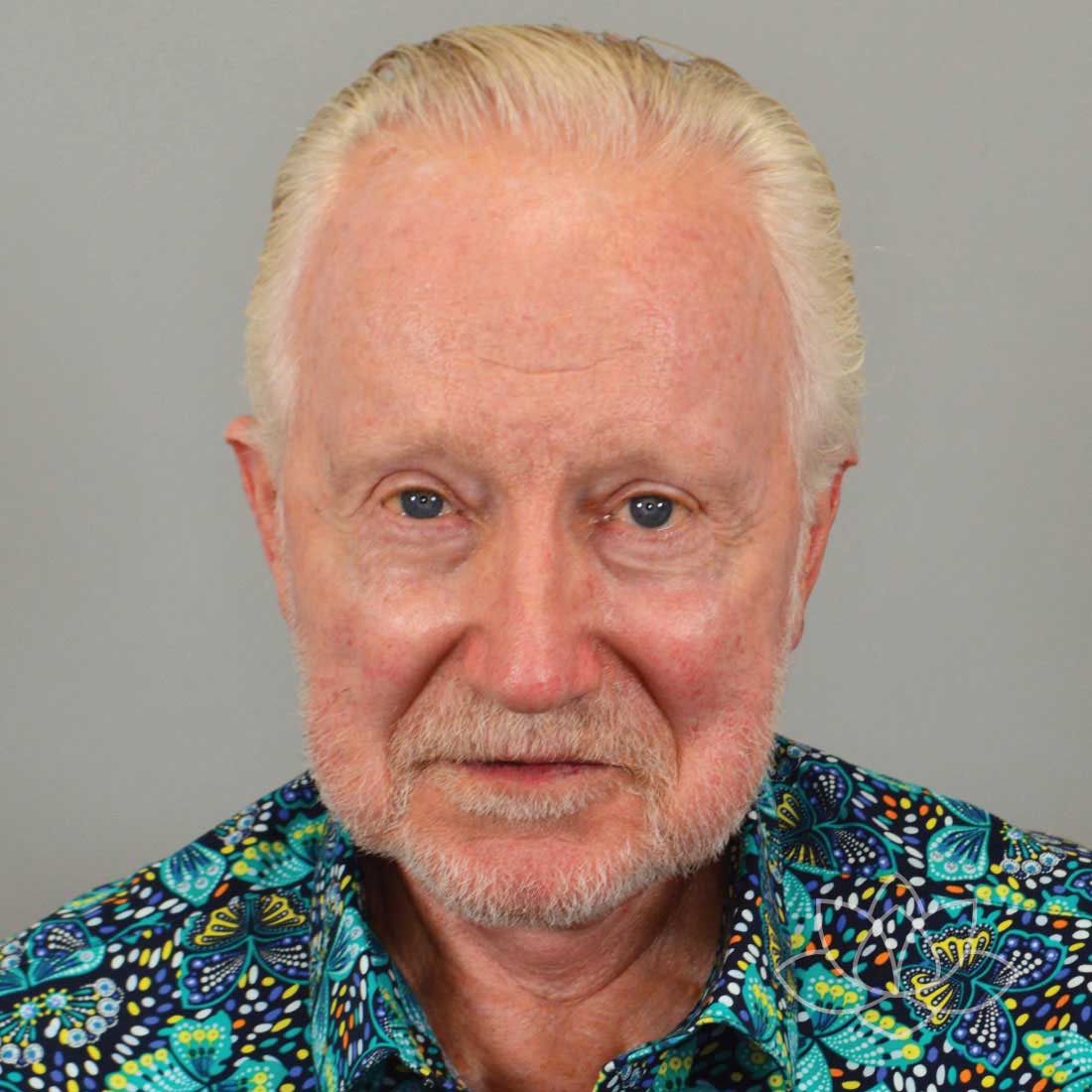 Eyelid Surgery After