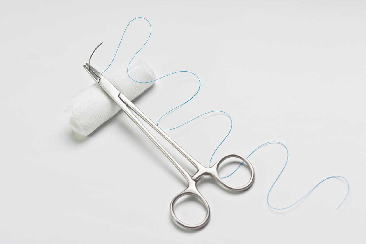 How do we close surgical incisions? - Wallin
